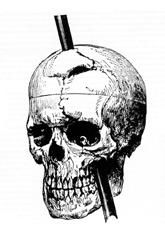 drawing of phineas gage's skull